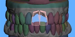 cirurgia-estetica-02